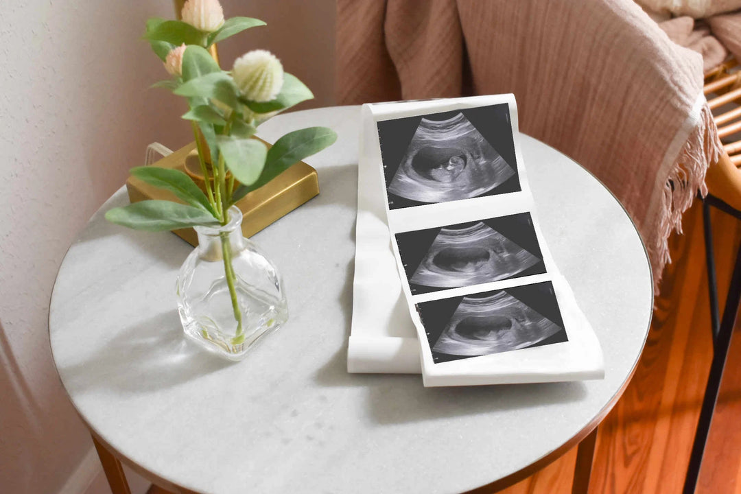 Three ultrasound images displayed on a white cloth on a round marble table with a small glass vase and leaves.